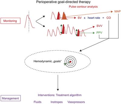 Perioperative Goal-Directed Therapy Using Invasive Uncalibrated Pulse Contour Analysis